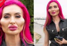 另类整容!女子迷恋填充脸颊,肿如外星人|趣观世界