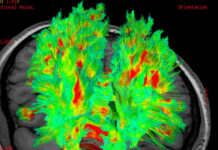 研究显示心脏骤停后人或仍有意识