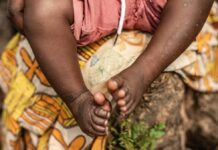 世卫拉响最高警报 猴痘疫情现在怎么样了?